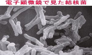 結核菌の画像