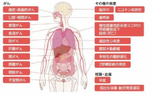 たばこを吸っている本人はこんな病気になりやすくなる。